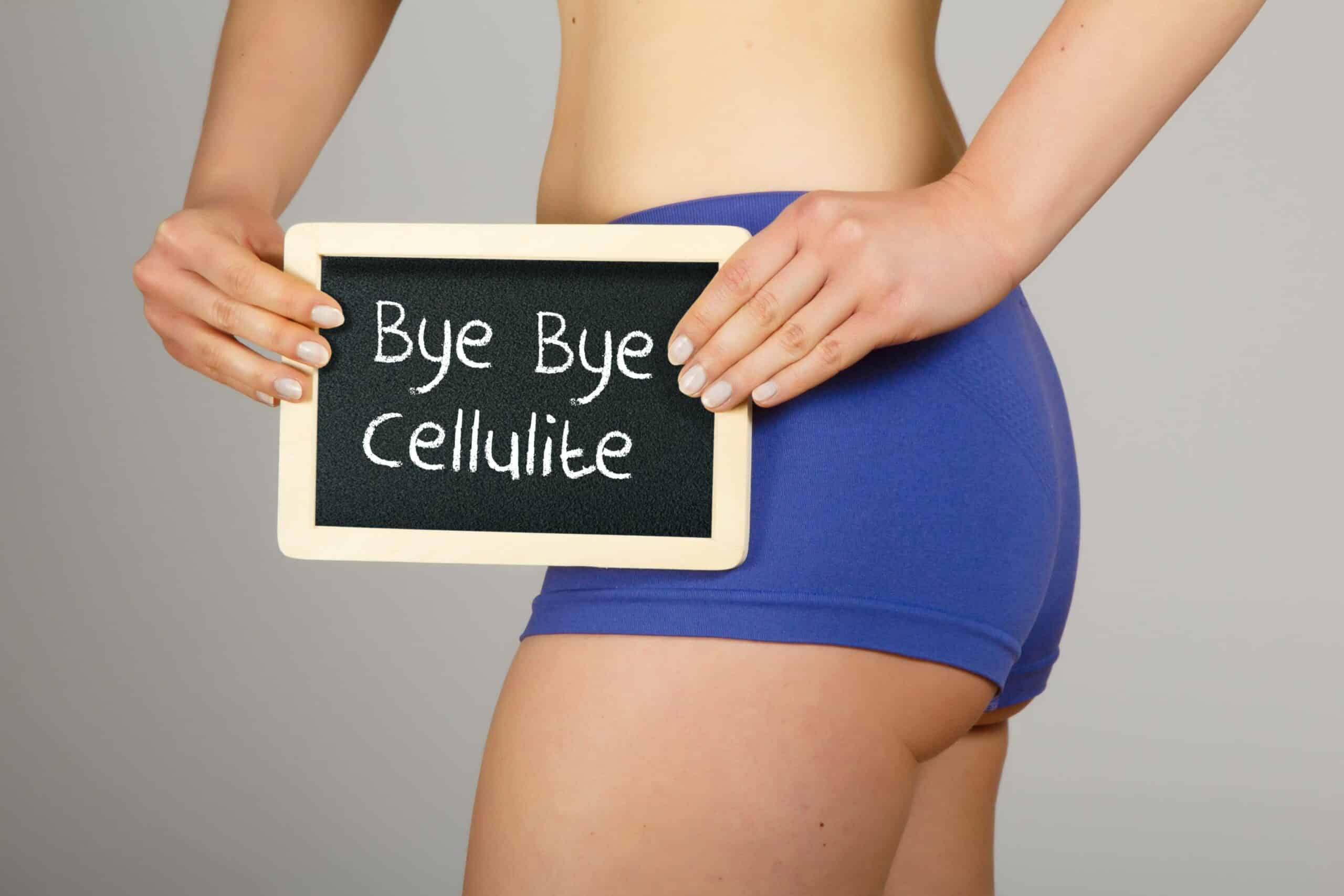 J’ai de la cellulite : traitements | Dr Christine Luneau | Aix-en-Provence